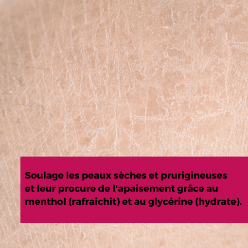 EXCIPIAL PRURI LOTION 200ML – Image 3