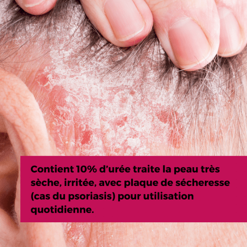 EXCIPIAL U10 LIPOLOTION 200ML – Image 2